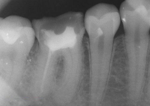 中國再生牙齒研究新進(jìn)展，重塑微笑，科技引領(lǐng)牙齒再生新篇章