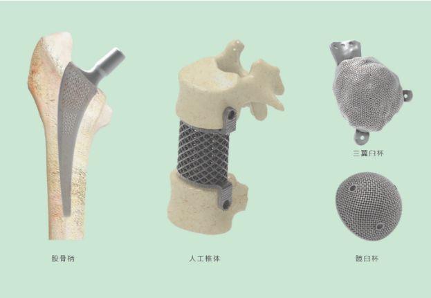 三維打印髖關(guān)節(jié)技術(shù)新動(dòng)態(tài)，重塑生活的科技魔法奇跡